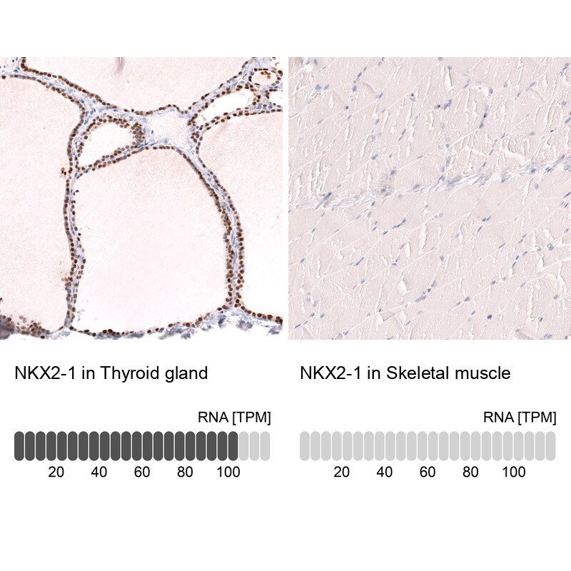 TTF-1 / NKX2-1 Antibody (CL14528)