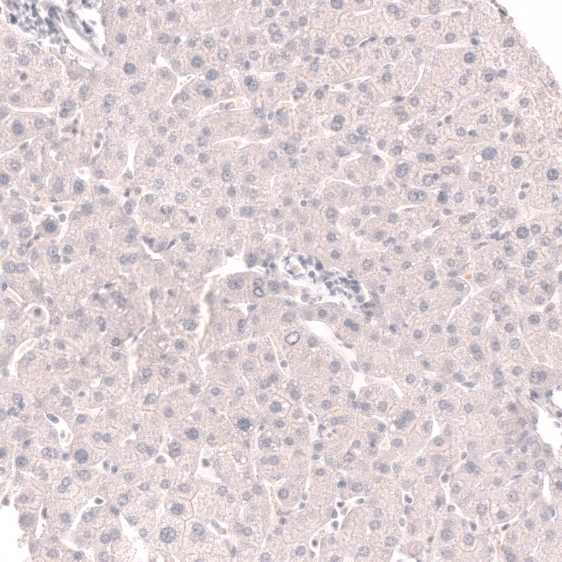 TTF-1 / NKX2-1 Antibody (CL14528)