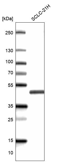 TTF-1 / NKX2-1 Antibody (CL14531)
