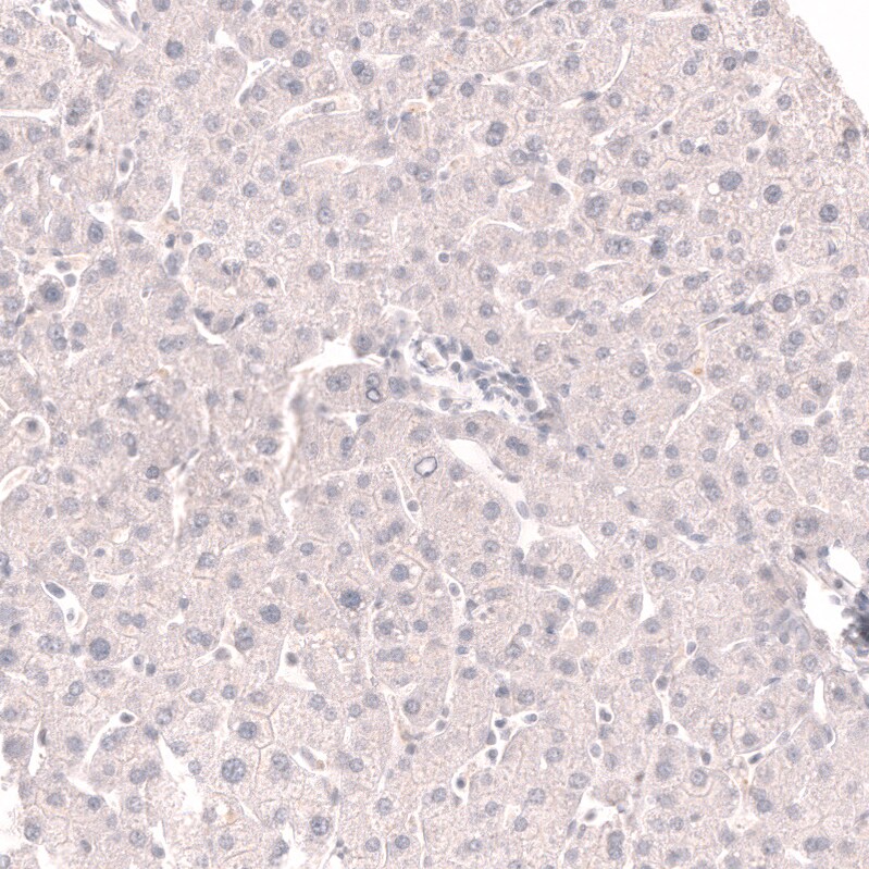 TTF-1 / NKX2-1 Antibody (CL14531)