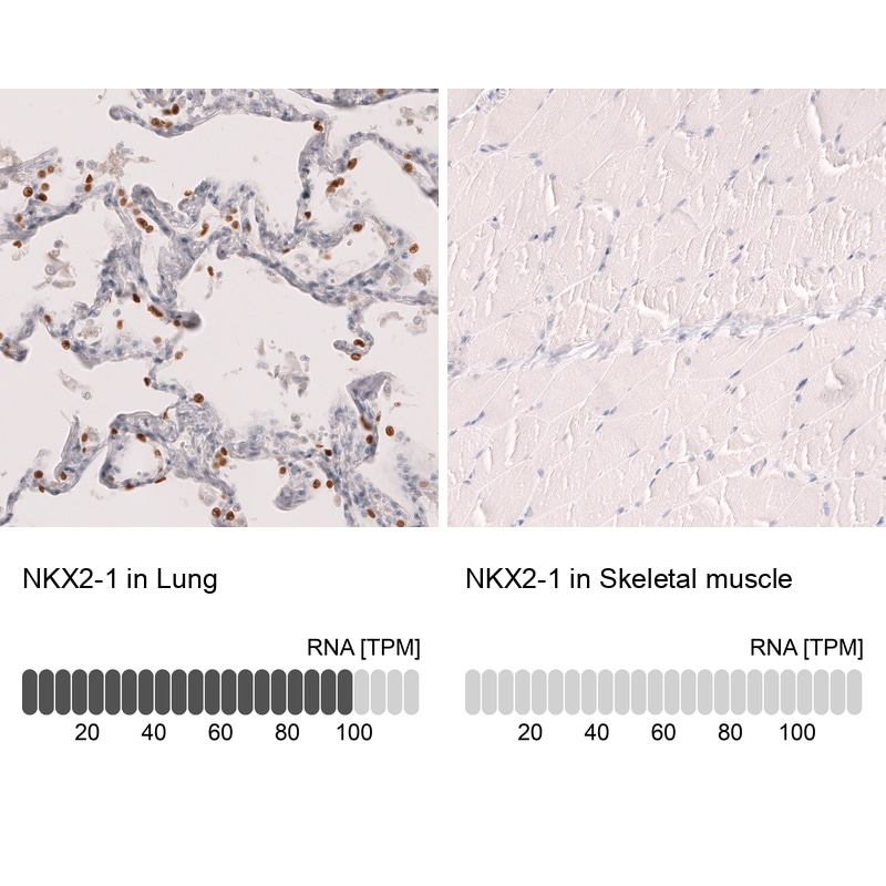 TTF-1 / NKX2-1 Antibody (CL14531)