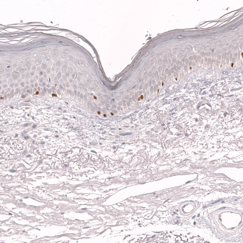 IRF4 Antibody (CL14615)