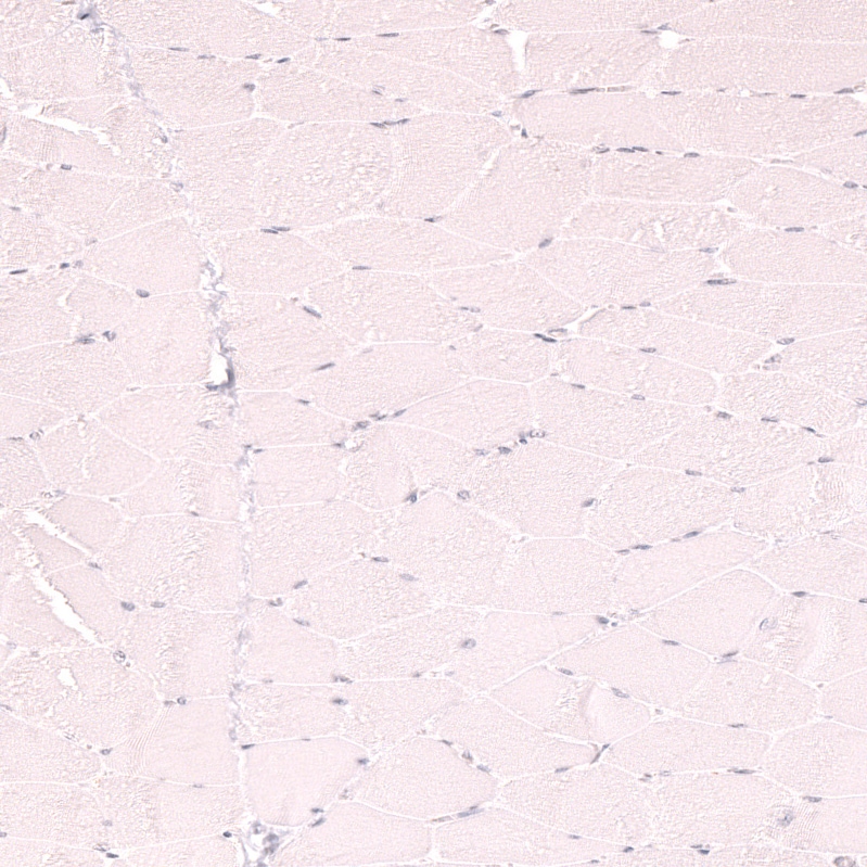 CD21 Antibody (CL14552)