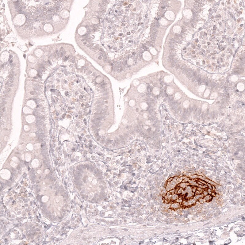 CD21 Antibody (CL14556)