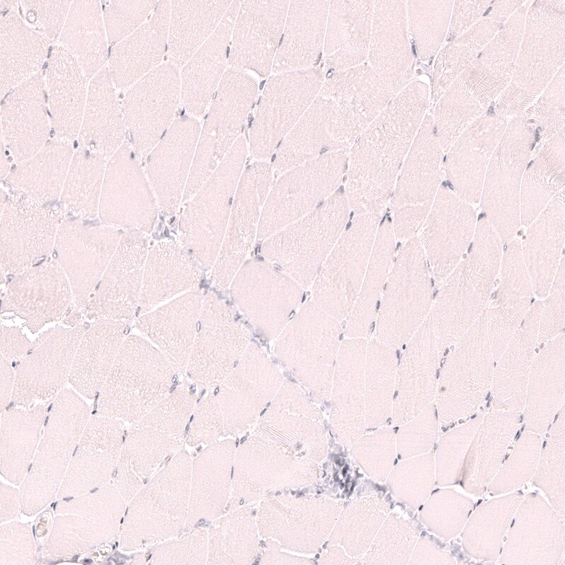 CD21 Antibody (CL14556)