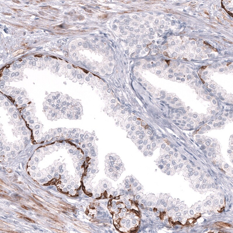 Cytokeratin 14 Antibody (CL14565)