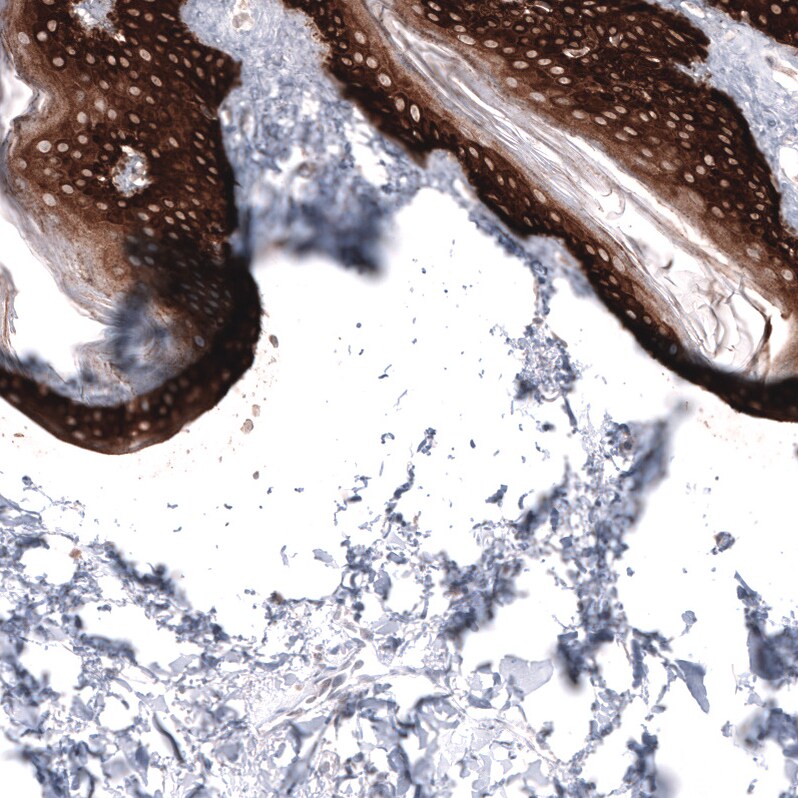 Cytokeratin 14 Antibody (CL14565)