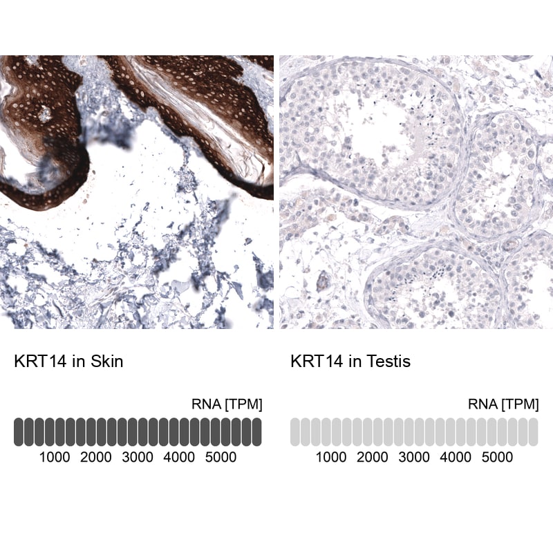 Cytokeratin 14 Antibody (CL14565)