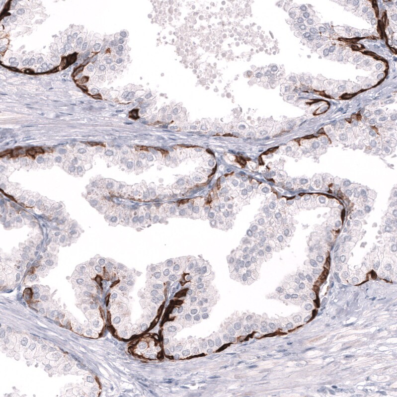 Cytokeratin 14 Antibody (CL14568)