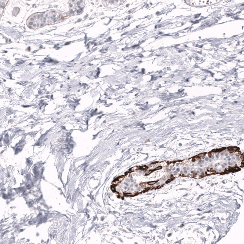 Cytokeratin 14 Antibody (CL14568)