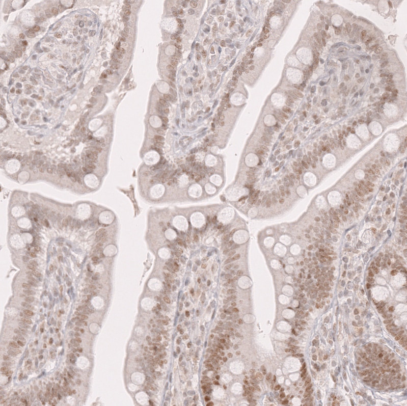 Bcl-6 Antibody (CL14611)