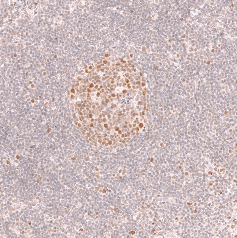 Bcl-6 Antibody (CL14611)