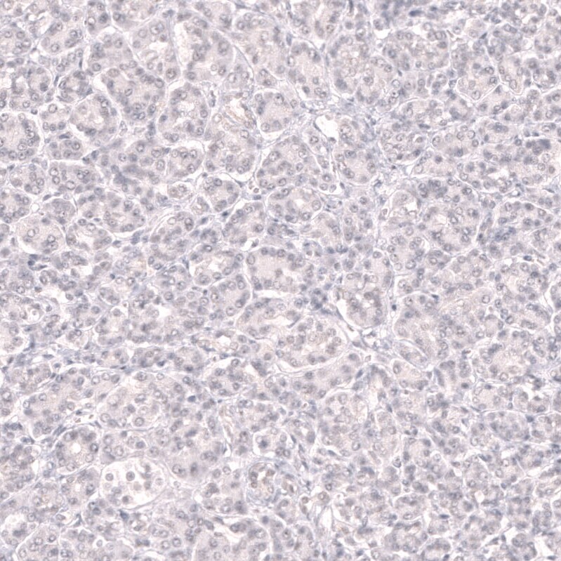 Bcl-6 Antibody (CL14612)