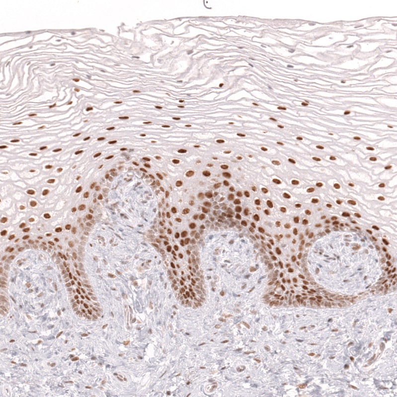 Bcl-6 Antibody (CL14612)