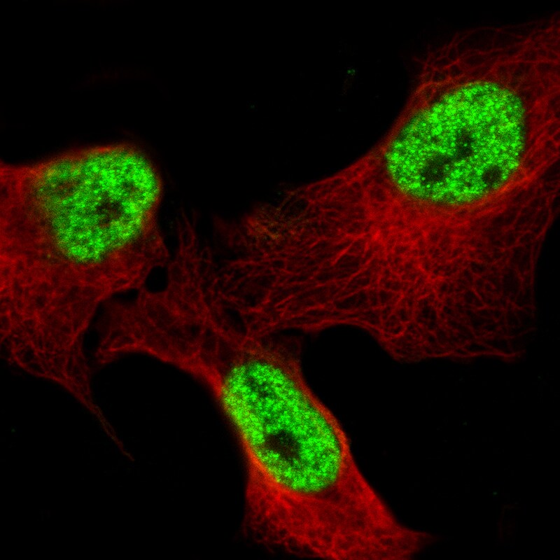 Bcl-6 Antibody (CL14612)