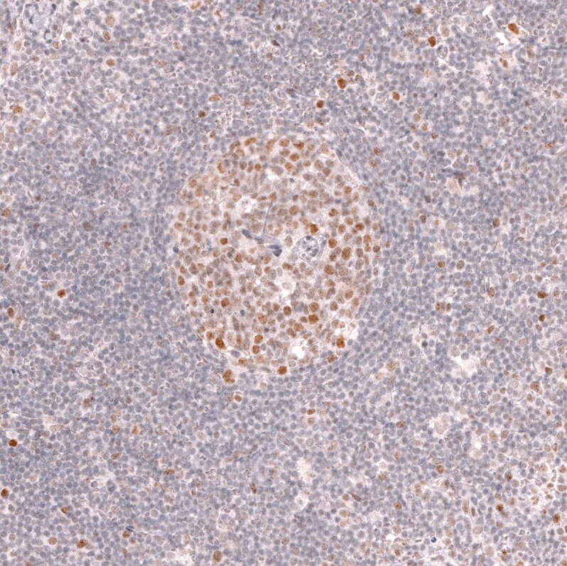 Bcl-6 Antibody (CL14612)