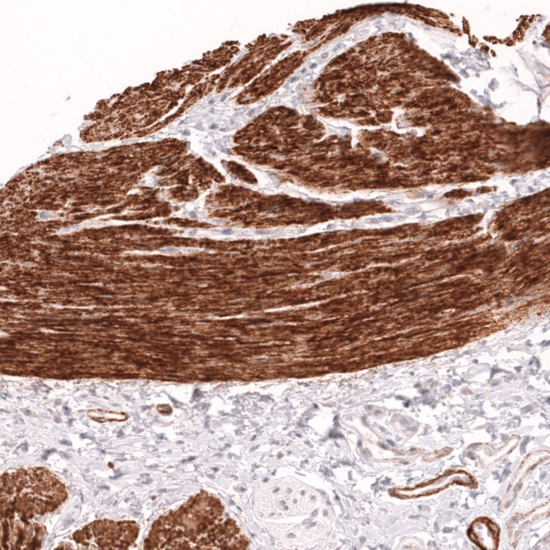 Myosin heavy chain 11 Antibody (CL14617)