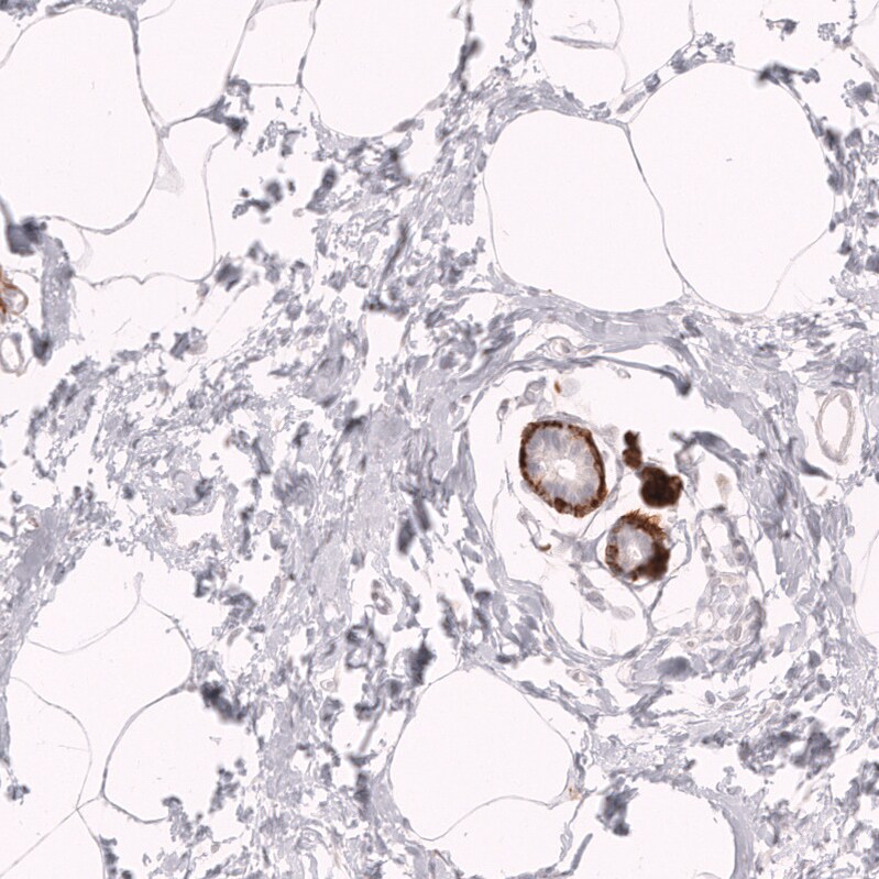 Myosin heavy chain 11 Antibody (CL14619)