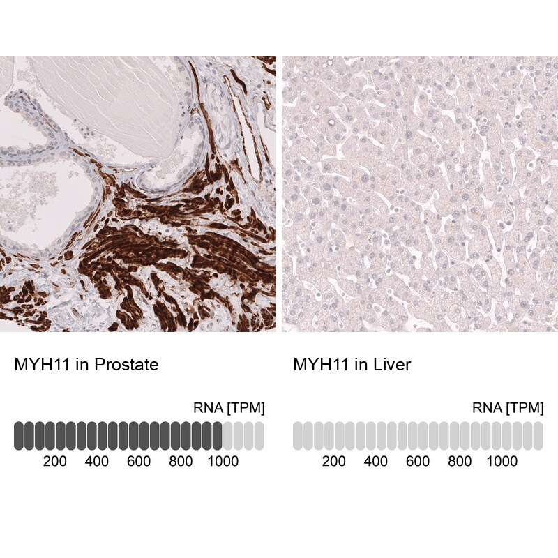 Myosin heavy chain 11 Antibody (CL14619)