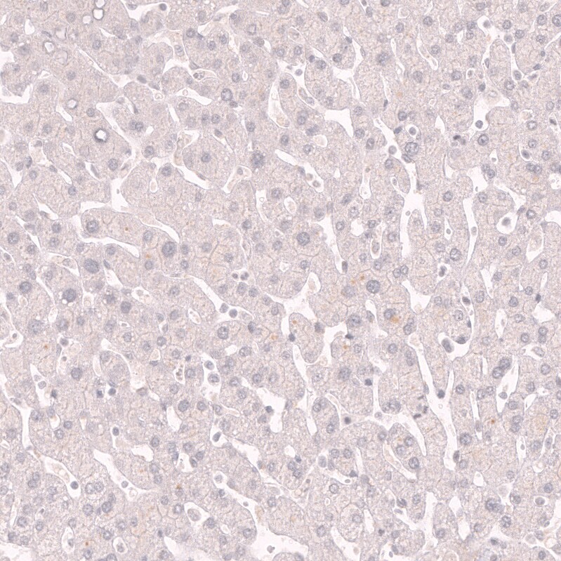 Myosin heavy chain 11 Antibody (CL14619)