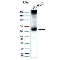 PRAME Antibody (PRAME/9189) - Azide and BSA Free Western Blot: PRAME Antibody (PRAME/9189) - Azide and BSA Free [NBP3-26933] -