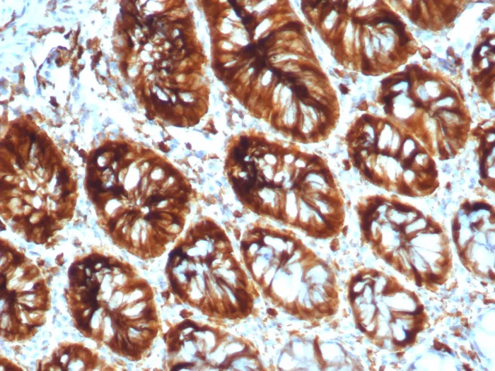 Stathmin 1 Antibody (STMN1/8012)