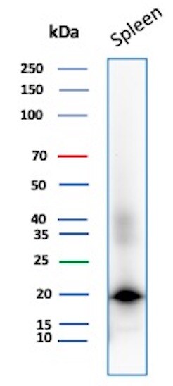 Stathmin 1 Antibody (STMN1/8012) - Azide and BSA Free Western Blot: Stathmin 1 Antibody (STMN1/8012) - Azide and BSA Free [NBP3-26960] -