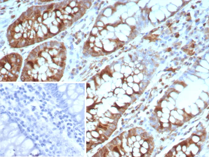 Stathmin 1 Antibody (STMN1/8437)