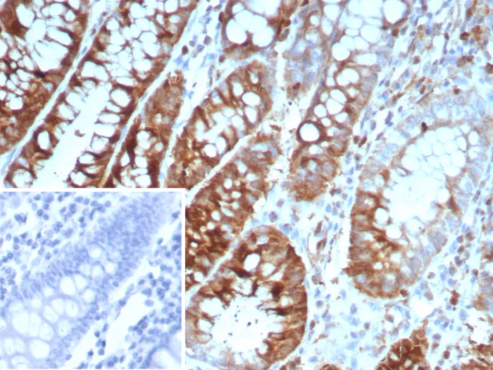 Stathmin 1 Antibody (STMN1/8439)