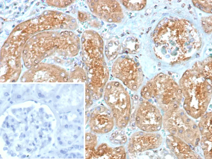 MxA/Mx1 Antibody (MX1/7530)