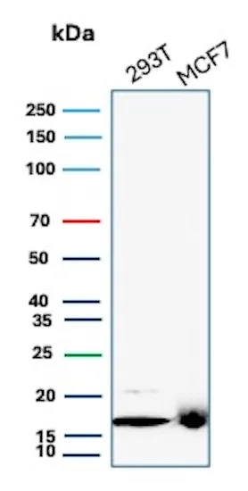 NM23-H2/NME2 Antibody (NME2/6433)
