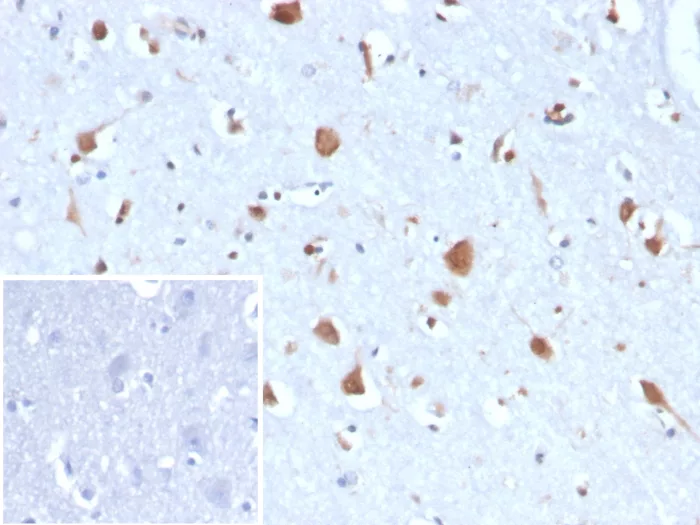 Carbonic Anhydrase VIII/CA8 Antibody (CA8/6814)