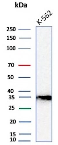 Carbonic Anhydrase VIII/CA8 Antibody (rCA8/8835) - Azide and BSA Free Western Blot: Carbonic Anhydrase VIII/CA8 Antibody (rCA8/8835) - Azide and BSA Free [NBP3-27031] -