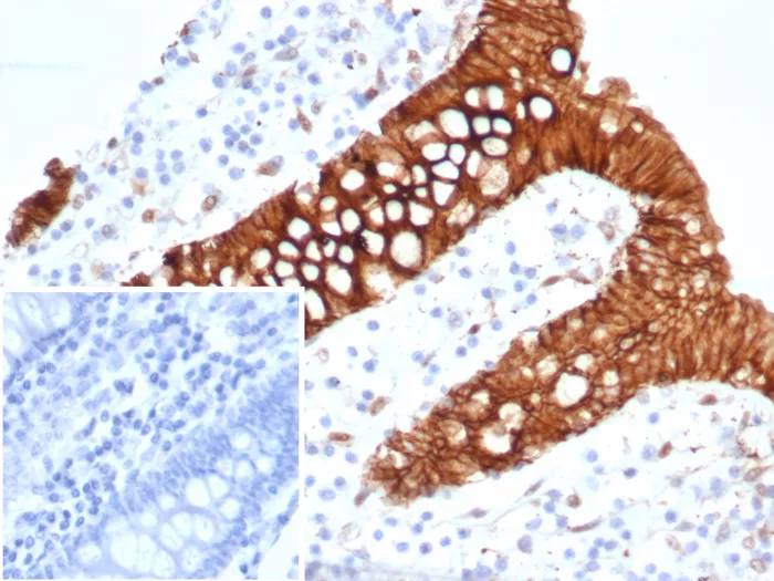 S100A16 Antibody (S100A16/7412)