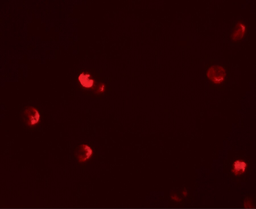 p57 Kip2 Antibody