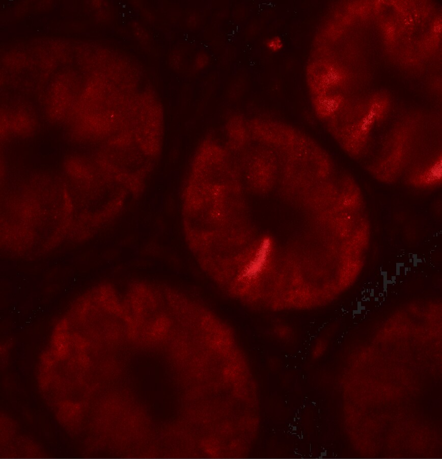 TOX Antibody