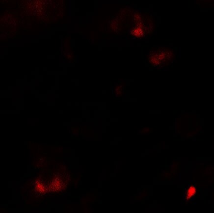 SAMSN1 Antibody