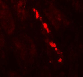 Myosin VIIb Antibody