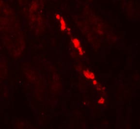 Myosin VIIb Antibody