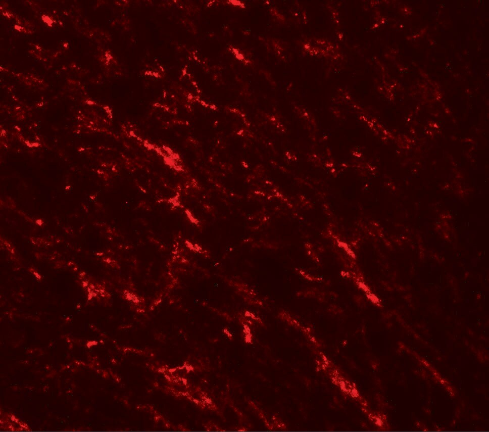 TIP60 Antibody