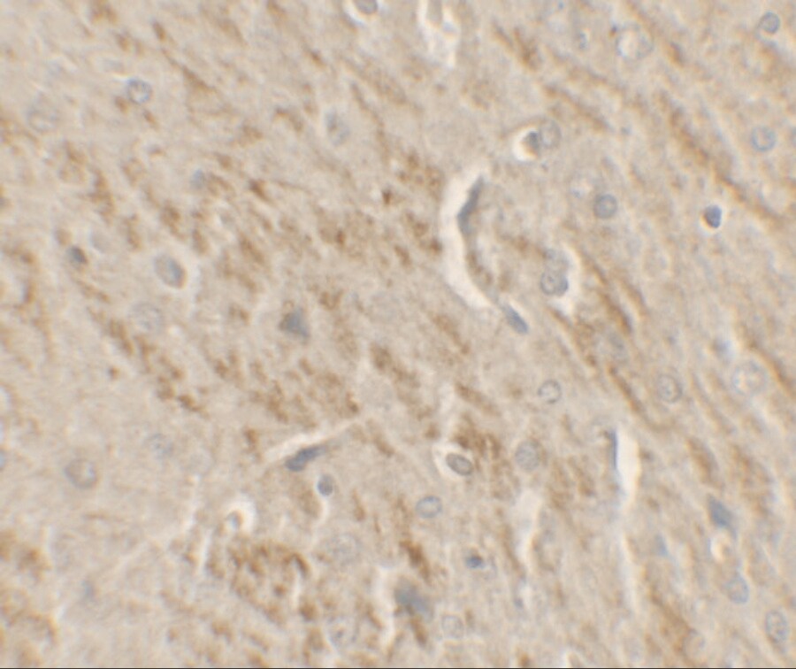 TIP60 Antibody
