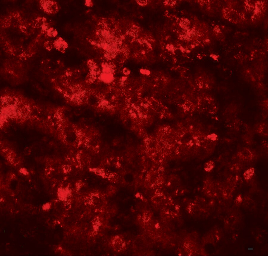 RNF20 Antibody