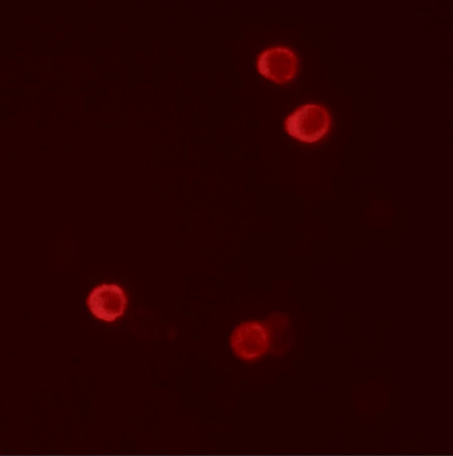 FHIT Antibody