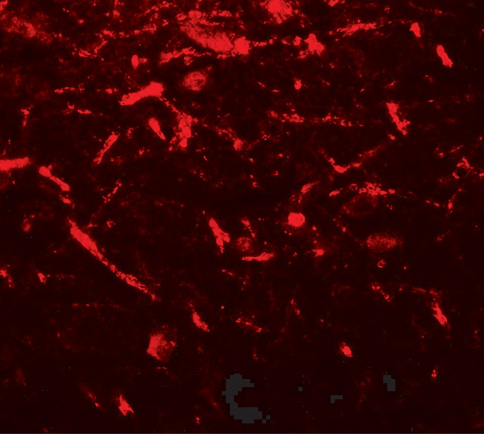 FMRP Antibody