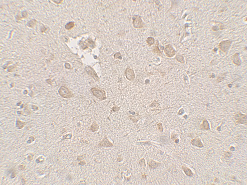 FMRP Antibody