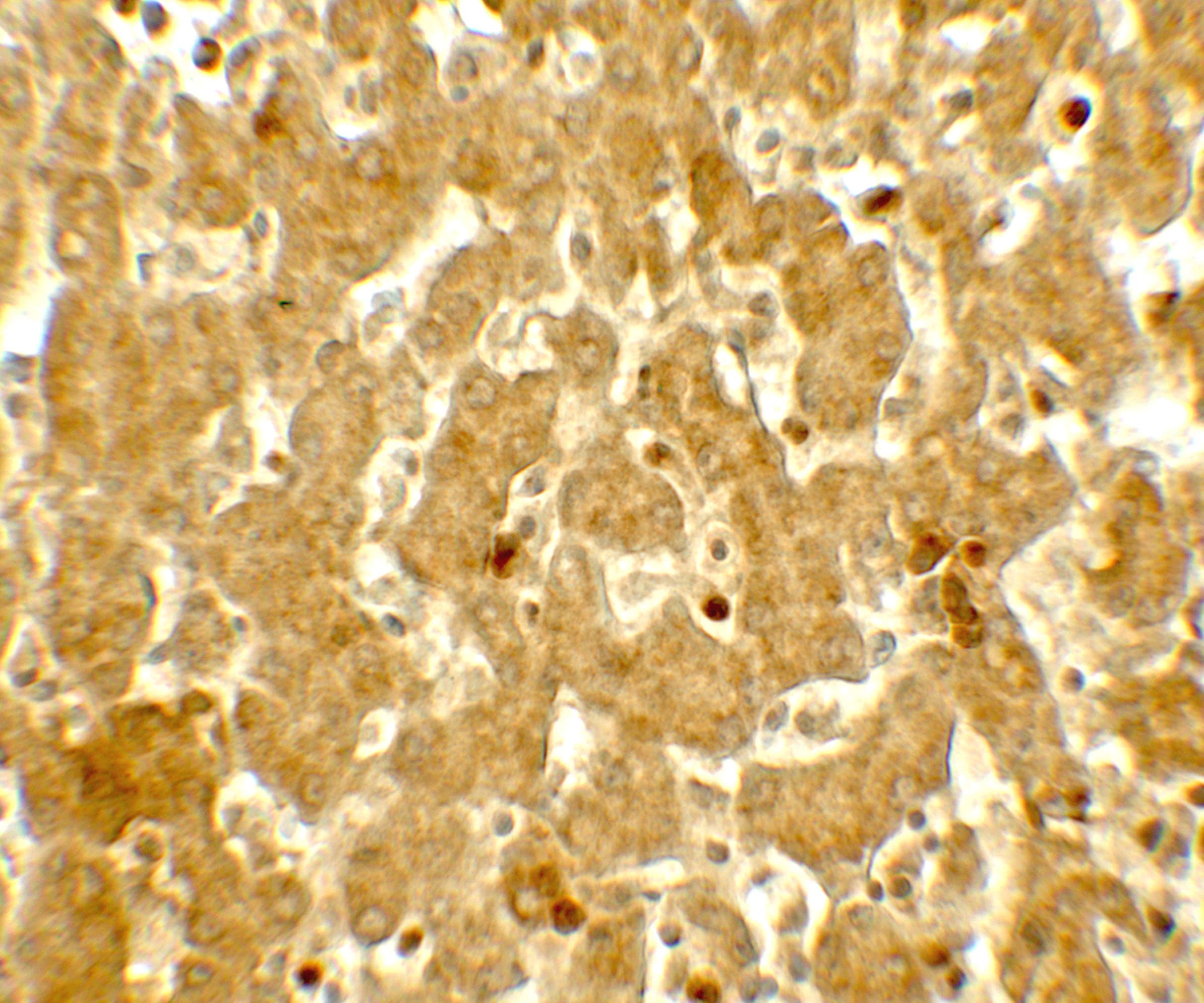 IFIT3 Antibody