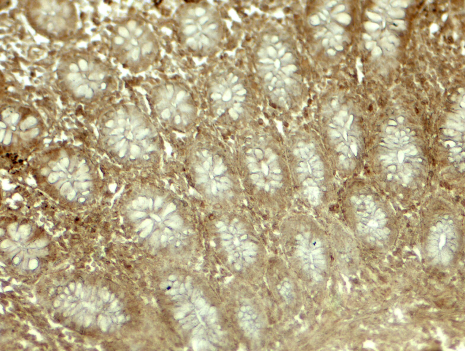 EPLIN Antibody