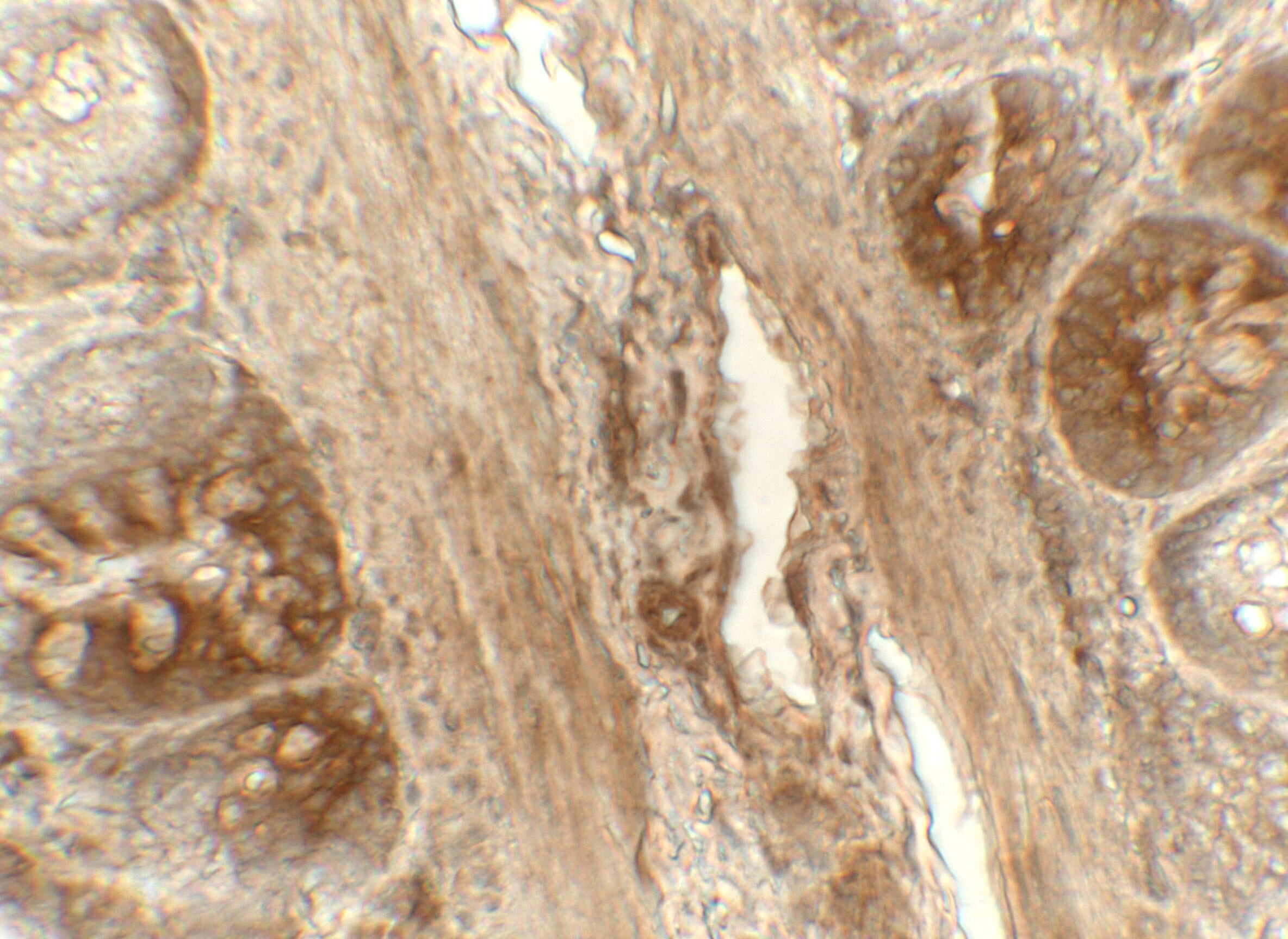 ERp72 Antibody