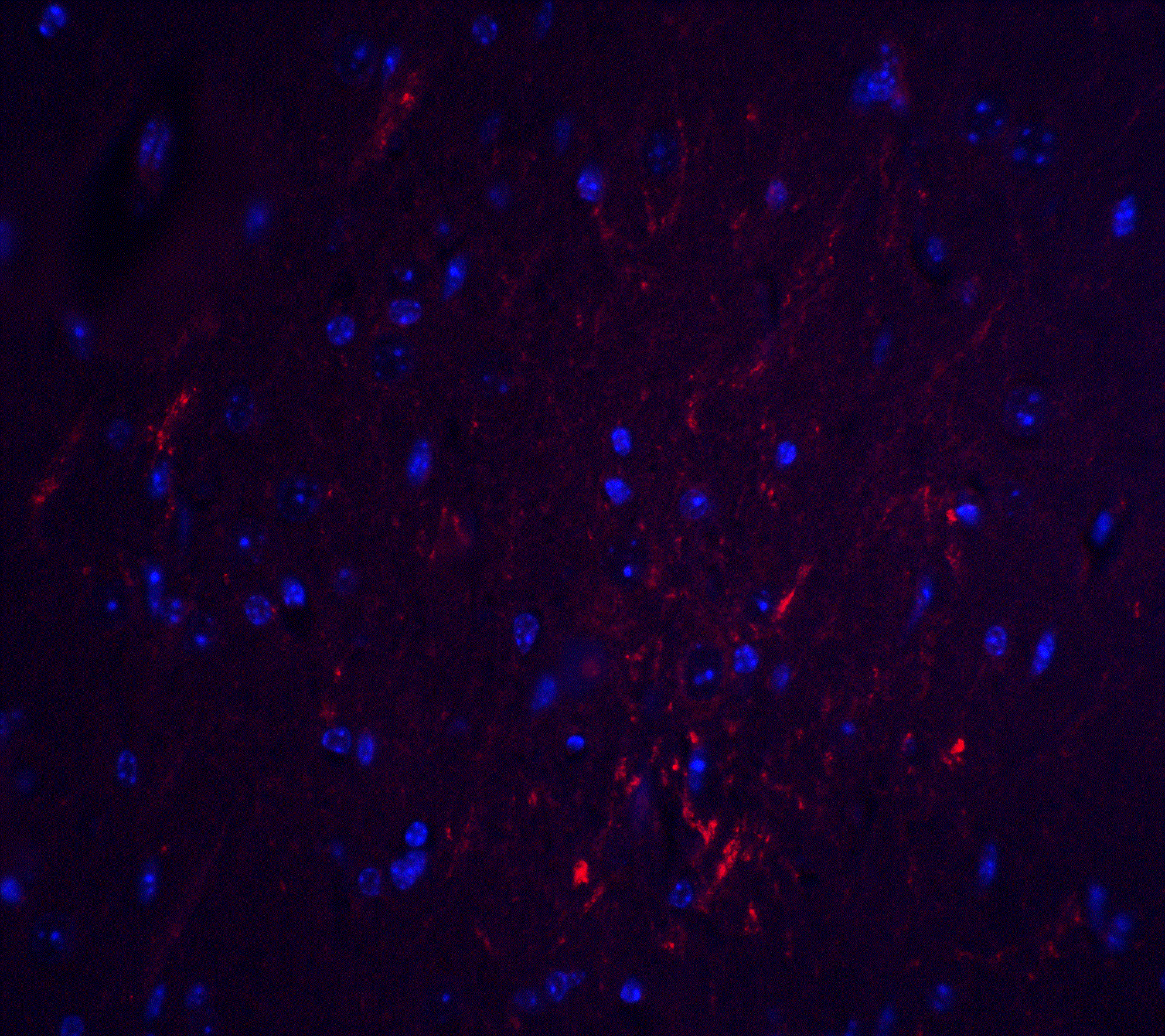 S1P2/EDG-5/S1PR2 Antibody