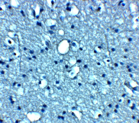 VTI1B Antibody